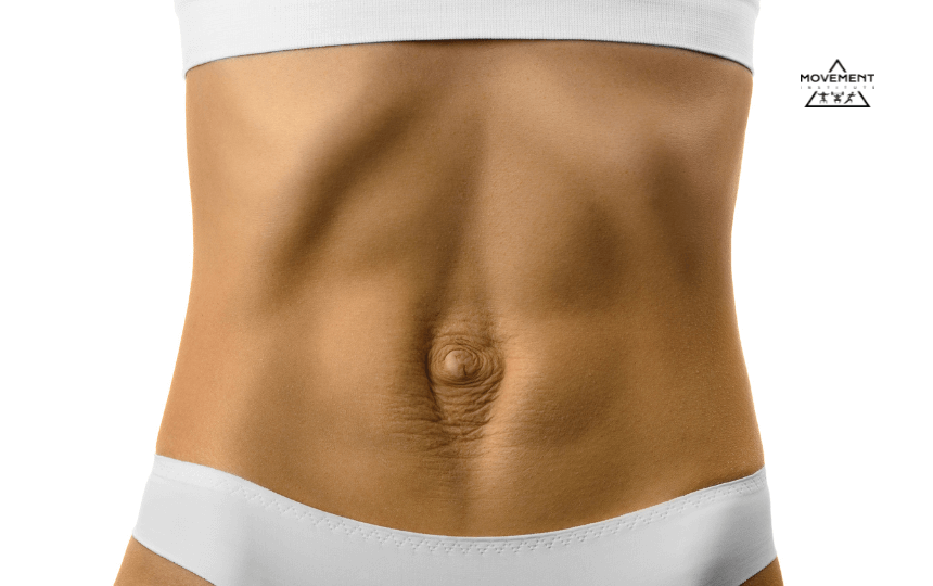 Diastázu môžete mať nie len po pôrode. Diastasis rectus abdominis.